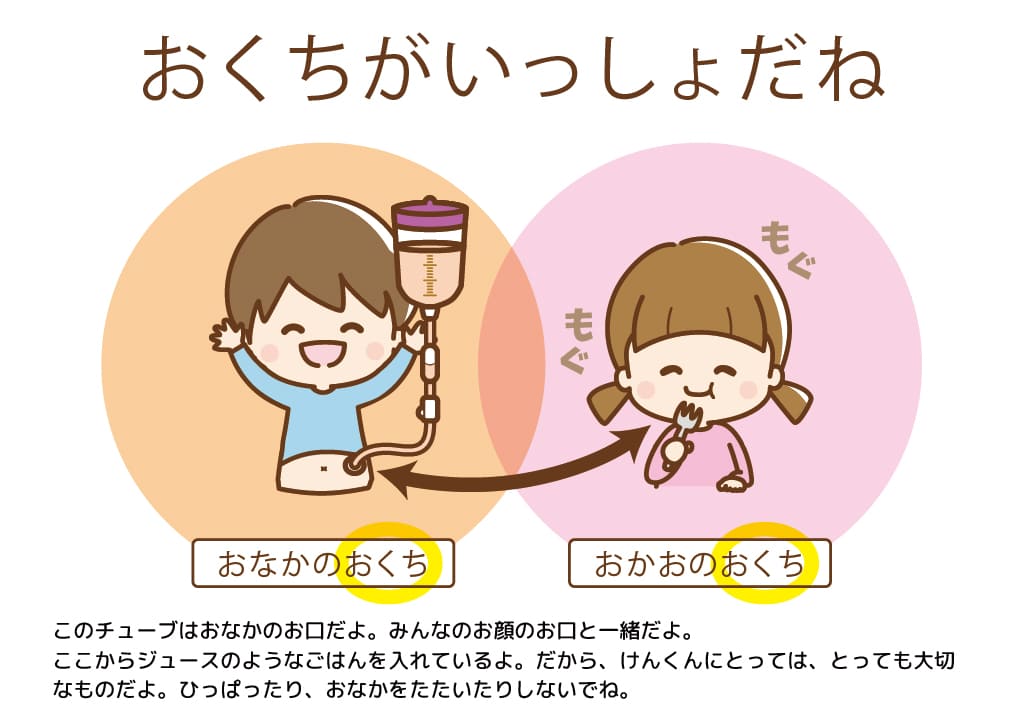 このチューブはおなかのお口だよ。みんなのお顔のお口と一緒だよ。ここからジュースのようなごはんを入れているよ。だから、けんくんにとっては、とっても大切なものだよ。ひっぱったり、おなかをたたいたりしないでね。